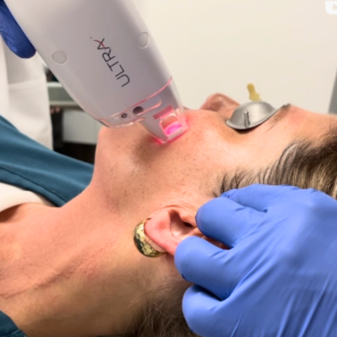 LP LAseMD Ultra 6 Laser Thulium